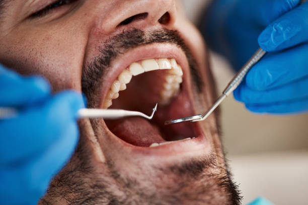 Best Emergency Treatment for Dental Infections or Abscesses in Camp Wood, TX